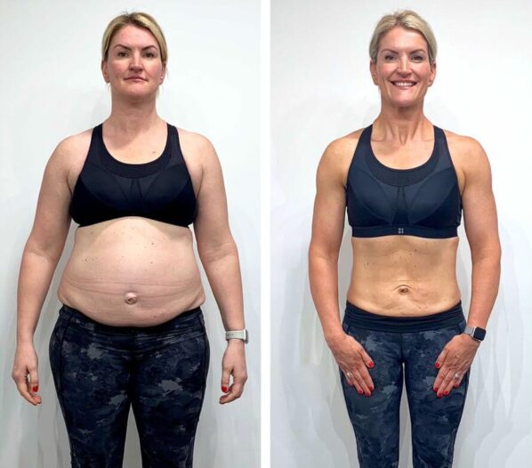 Weight Loss Peptides